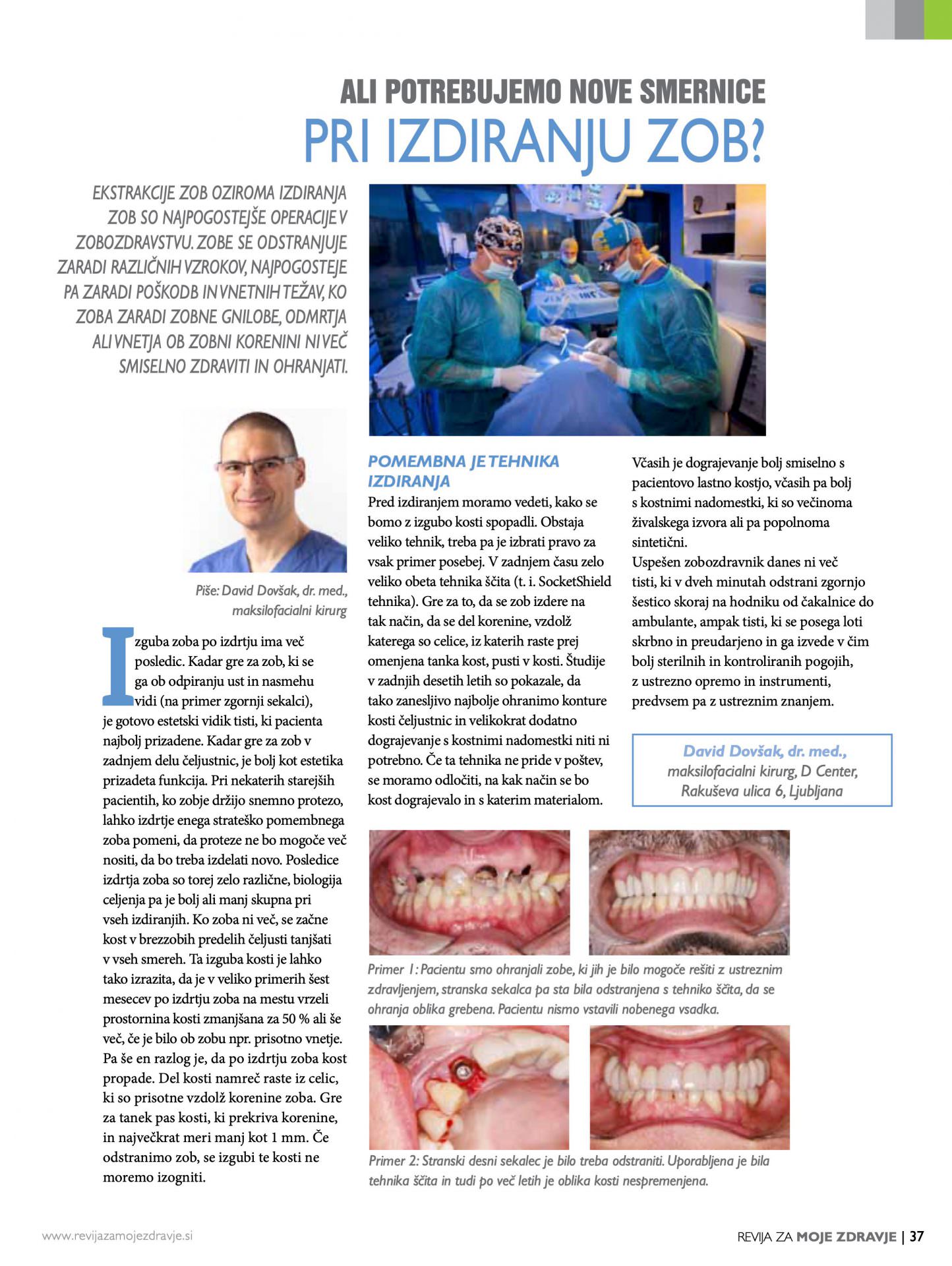 Še malo o izdiranju zob